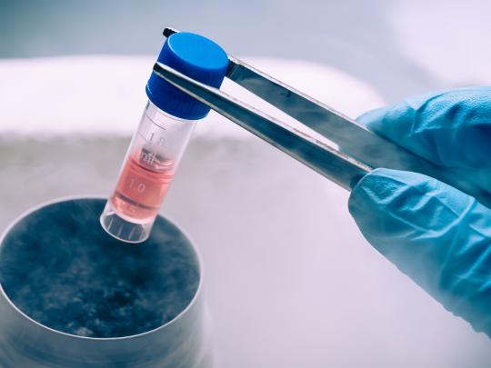 Mesenchymal Stem Cell Therapy